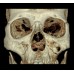 RAYSCAN M+ 160  Otorrinolaringología 